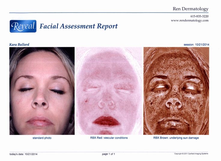 Reveal-Facial-Assessment