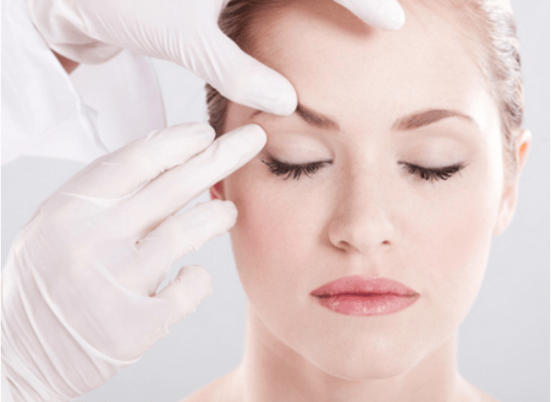 Why I Got Botox At 23 || By: Former Sun-Lover