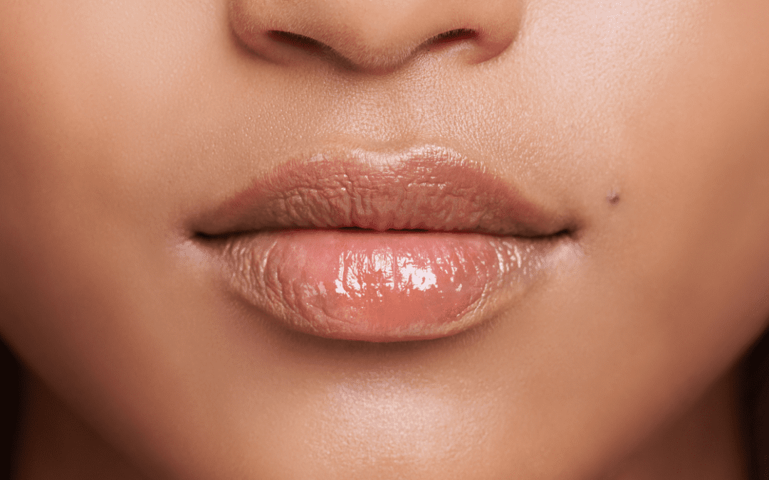 First Lip Filler: Essential Tips