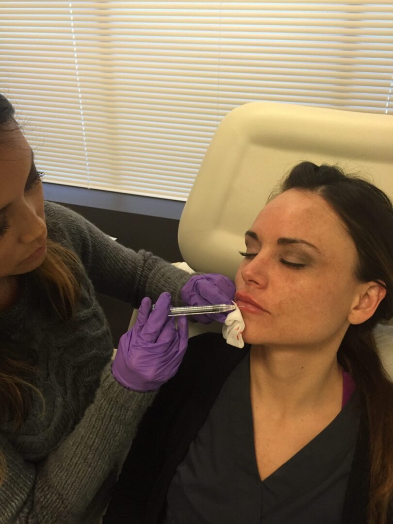 What to expect when getting lip fillers