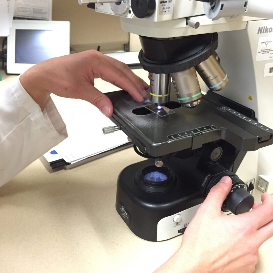 Have you ever wondered what happens after you get a biopsy?