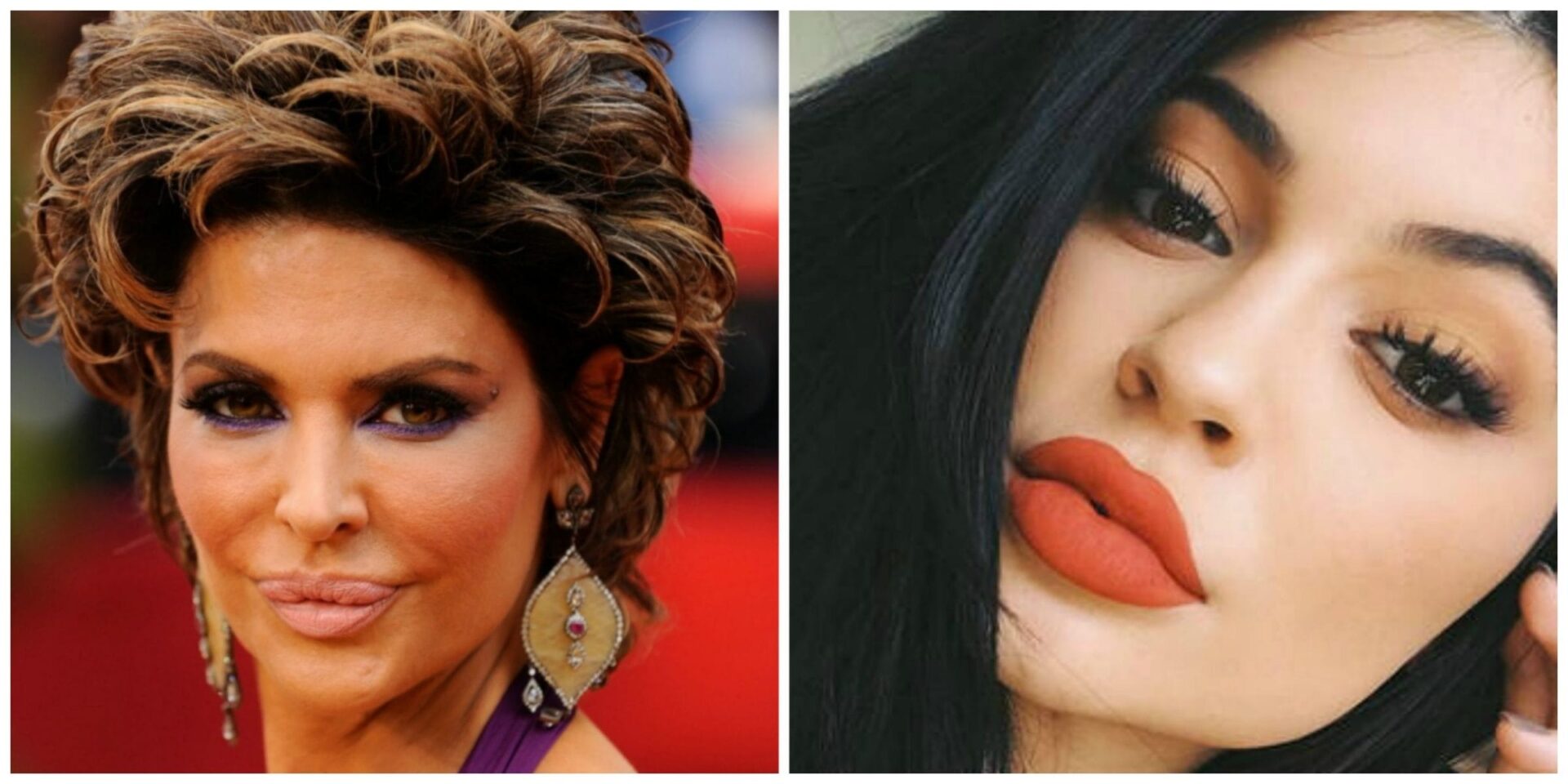 Are natural-looking lip injections possible? YES!