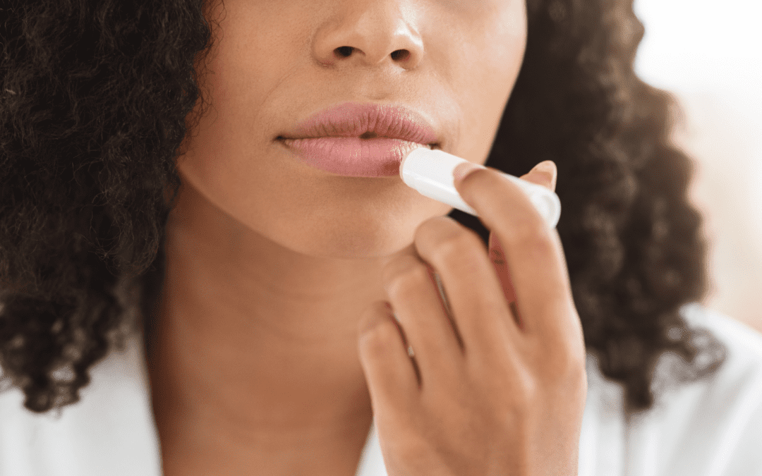 Avoid Dry, Chapped Lips this Winter